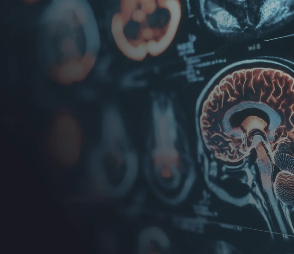 Cognitive bloodpanel